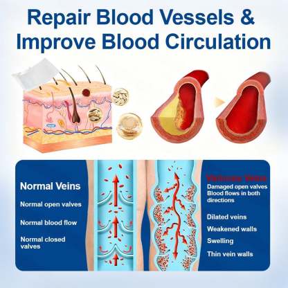 🇺🇸👨‍⚕️✅Owiwell® VeinEase Microneedle Care Patch⚡Instant Relief, Long-Term Results